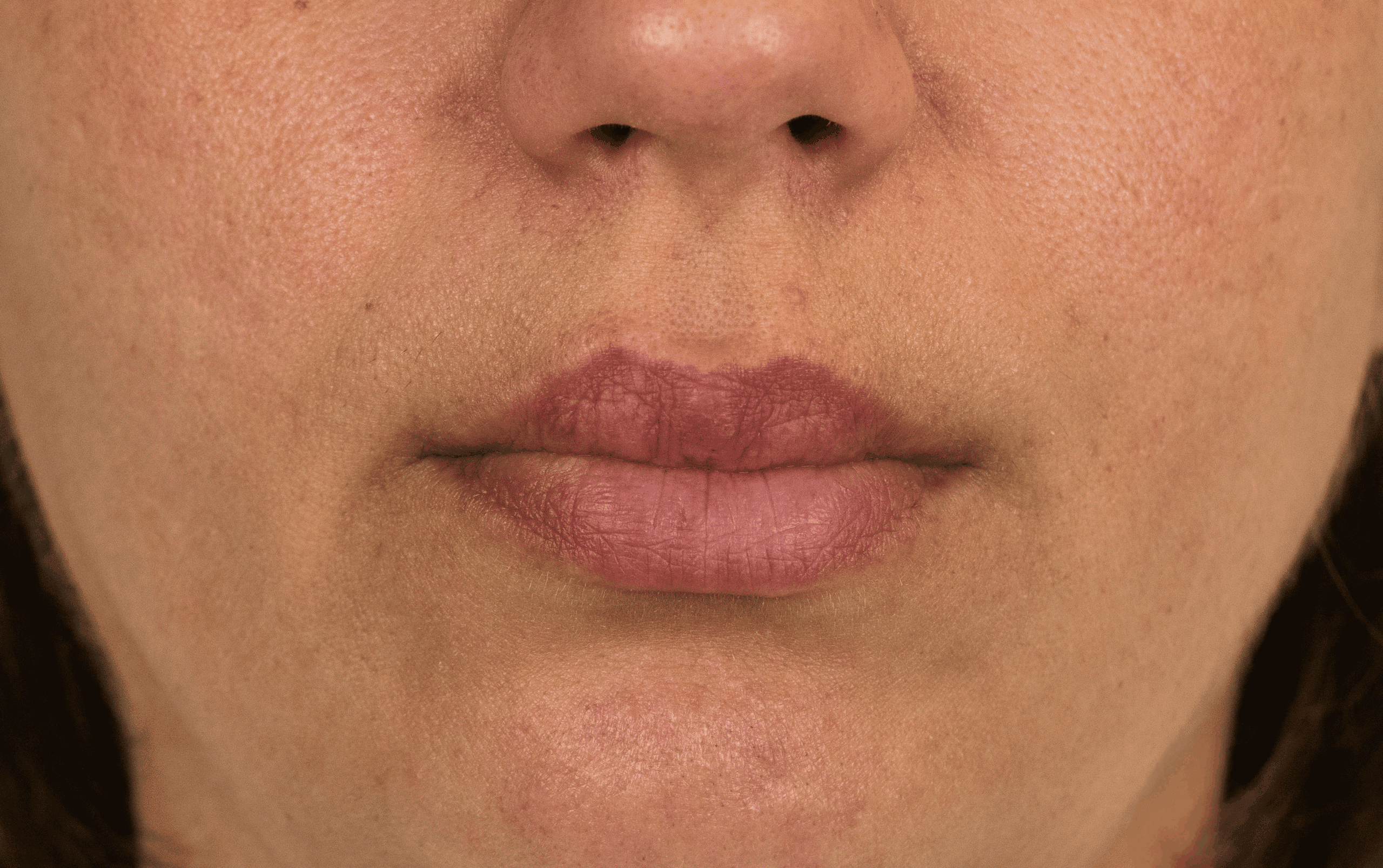 SOLTA_THERMAGE_HCP_BROCHURE_2025_05_12-28