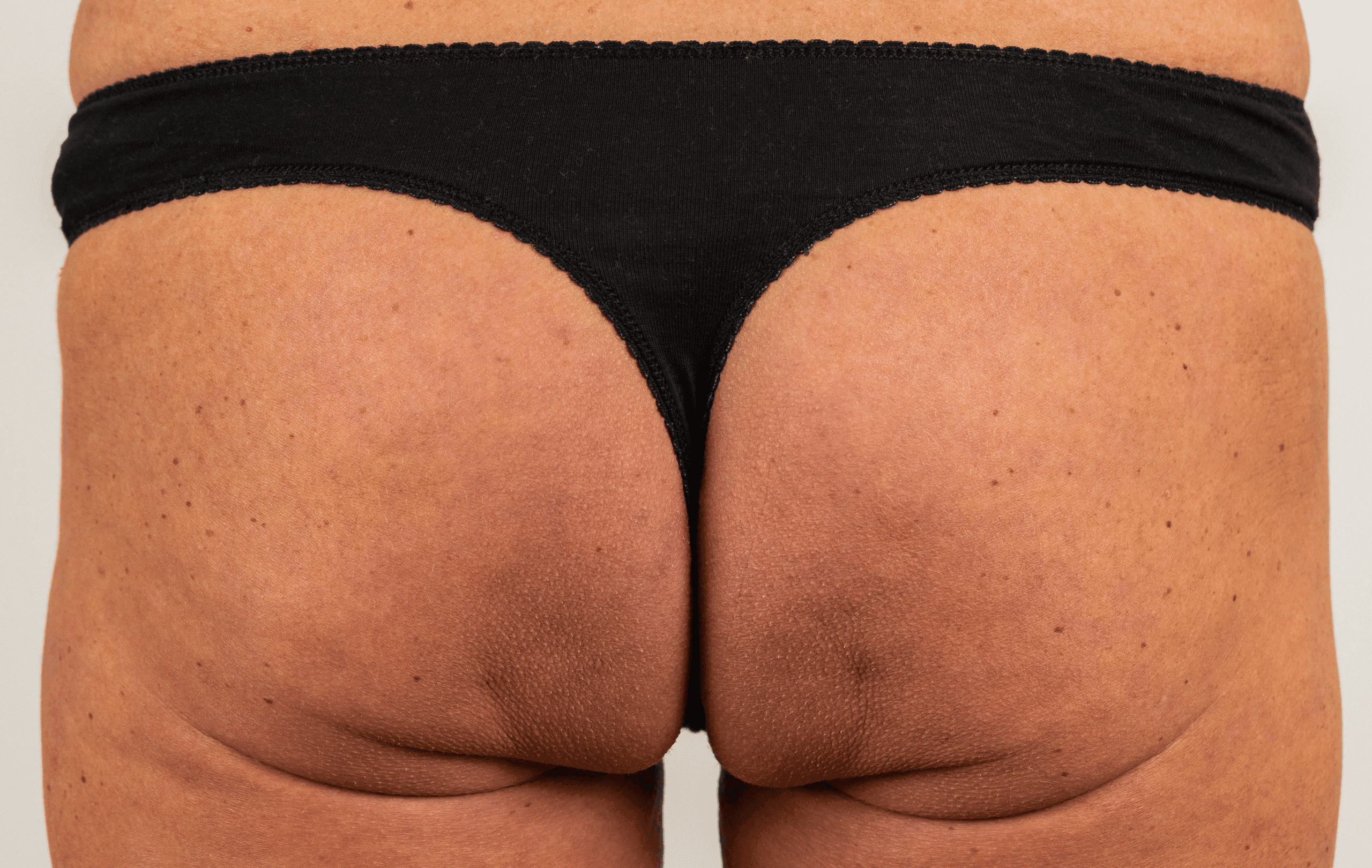 SOLTA_THERMAGE_HCP_BROCHURE_2025_05_12-29