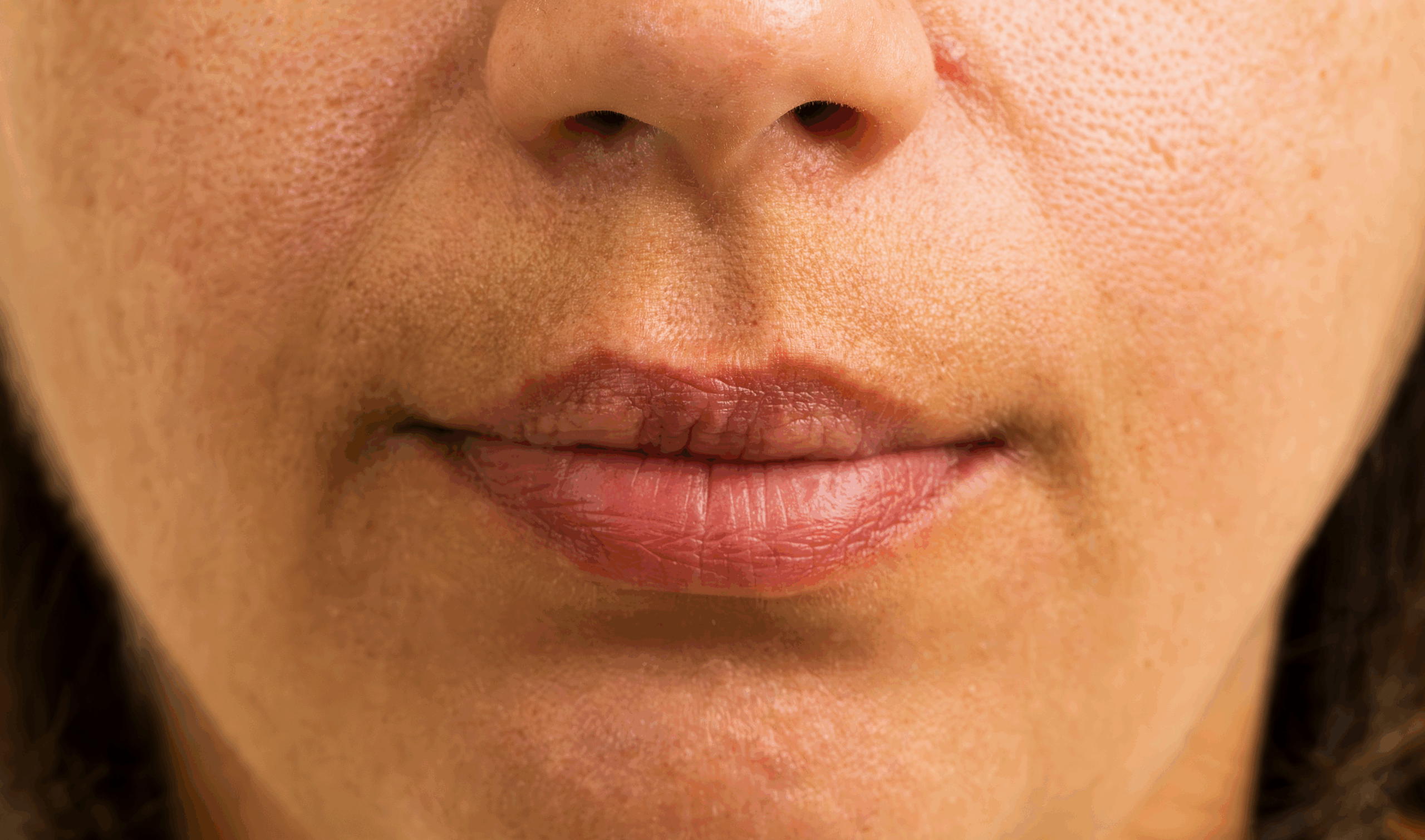 SOLTA_THERMAGE_HCP_BROCHURE_2025_05_12-30