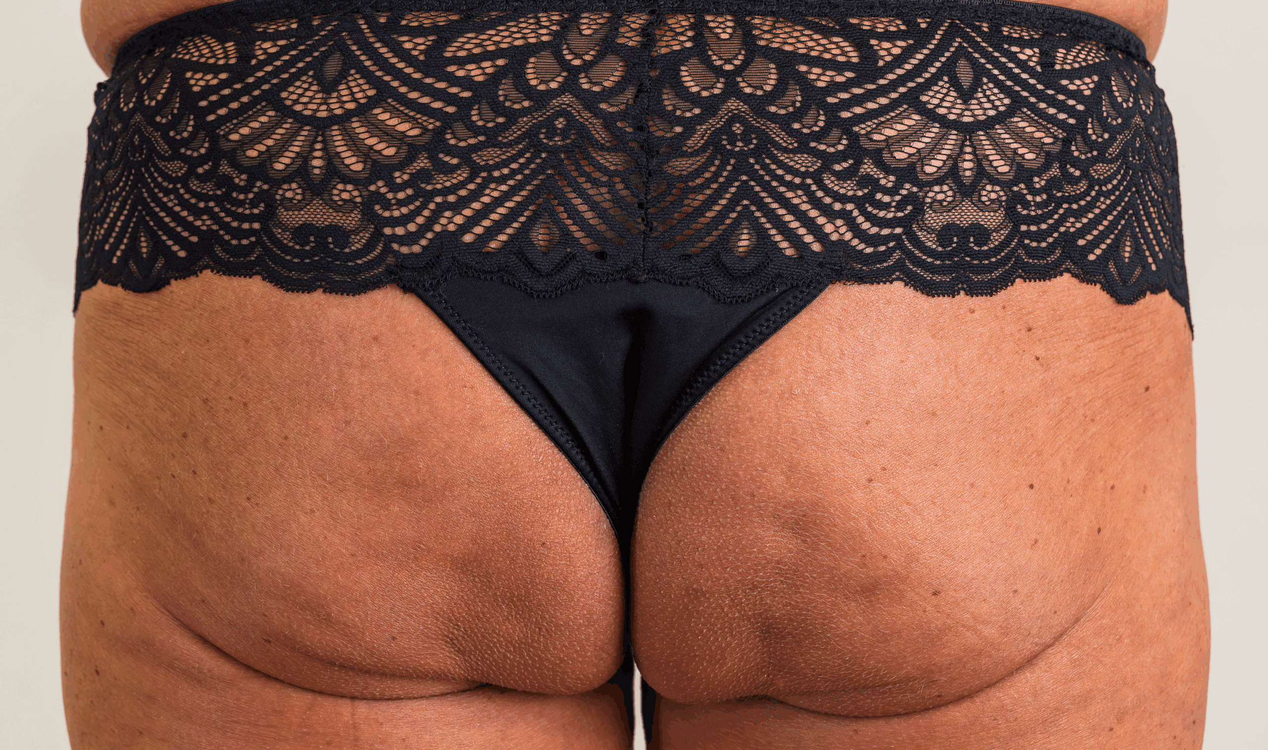 SOLTA_THERMAGE_HCP_BROCHURE_2025_05_12-31