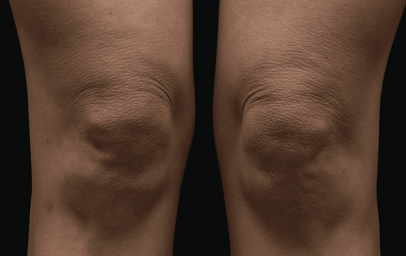 SOLTA_THERMAGE_HCP_BROCHURE_2025_05_12-33