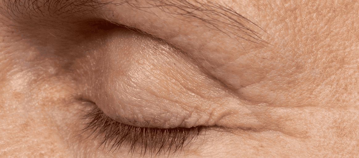 SOLTA_THERMAGE_HCP_BROCHURE_2025_05_12-38