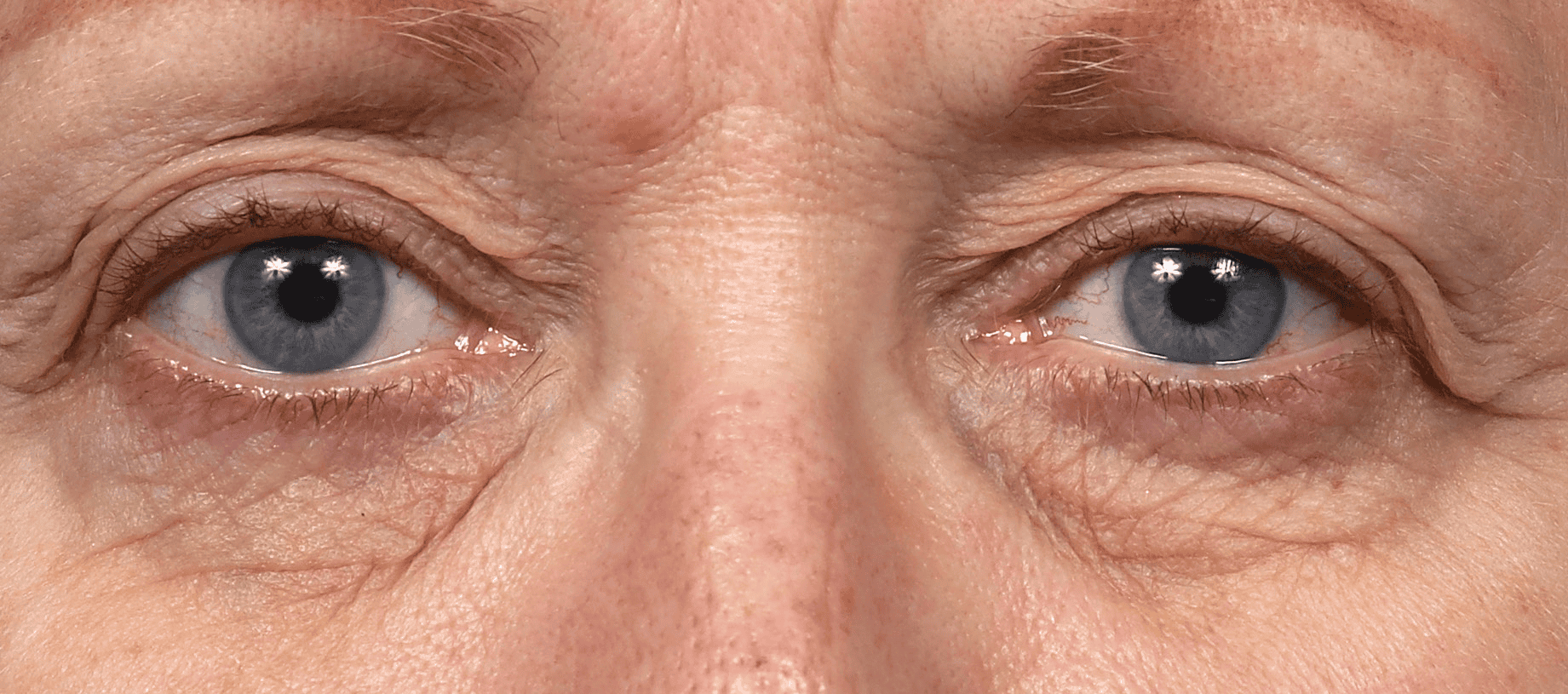 SOLTA_THERMAGE_HCP_BROCHURE_2025_05_12-40