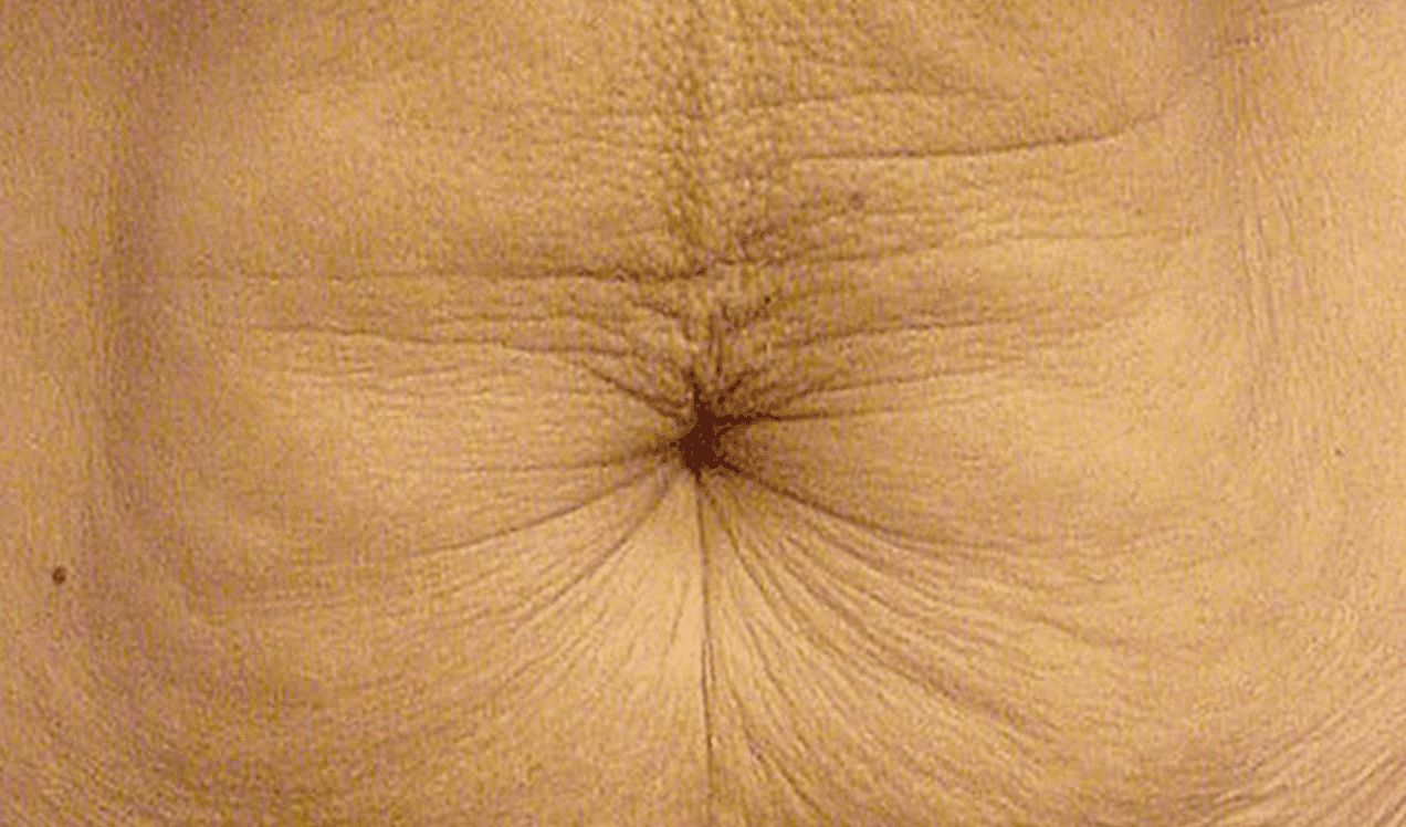 SOLTA_THERMAGE_HCP_BROCHURE_2025_05_12-46